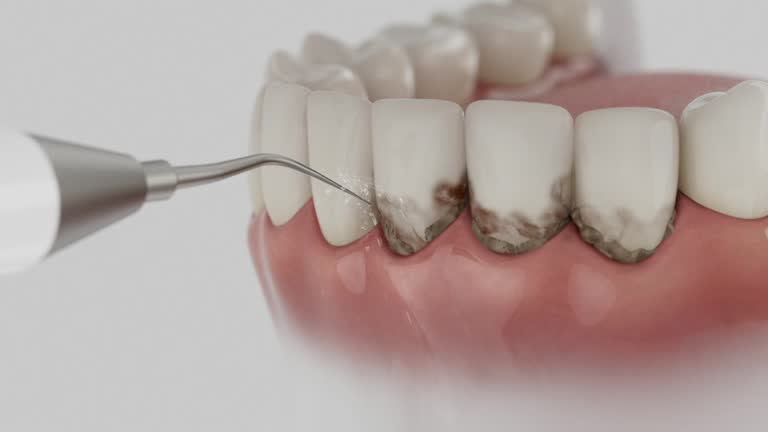 Reliable Dental Implants contractor in Twin Lakes, CA by Smile Center Dentistry